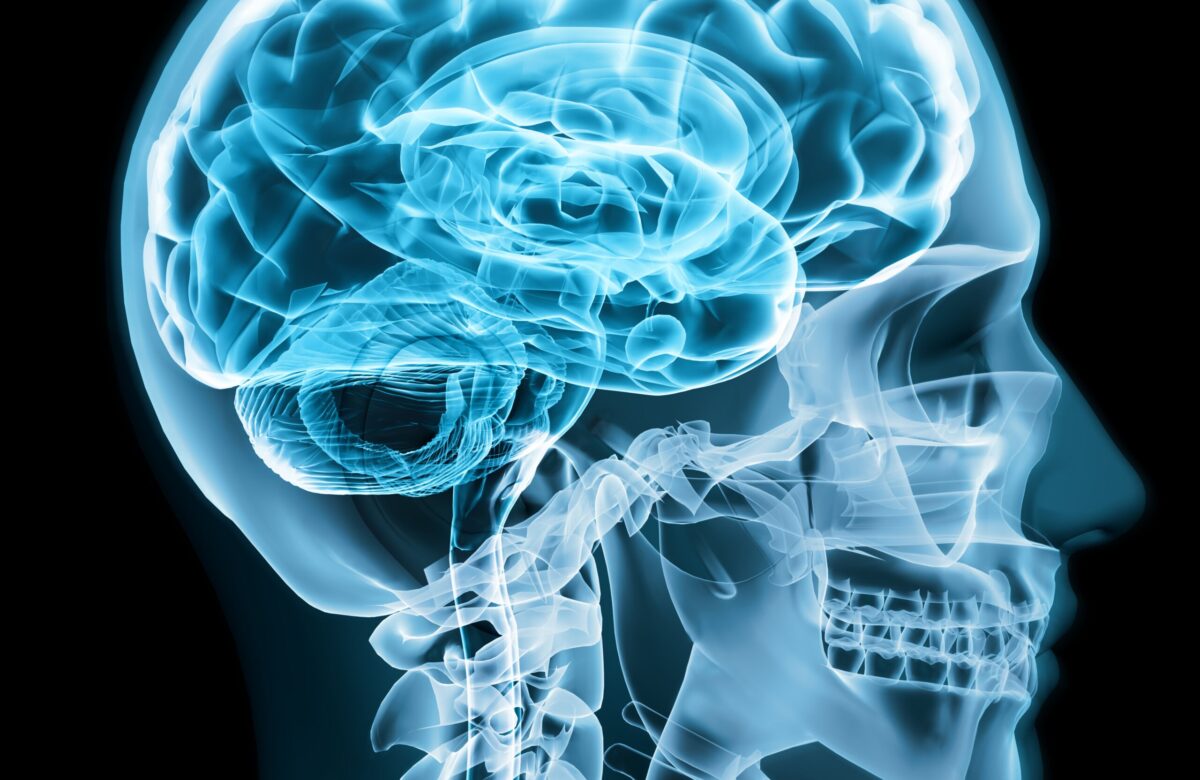 “Zakir” now 8 Case Study